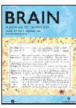 La revue brain 